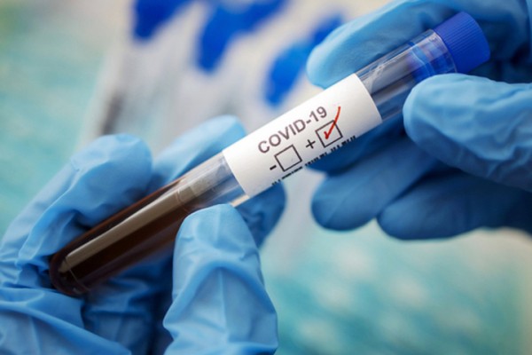 COVID-19 имеет уже несколько тысяч мутаций, часть из которых наследуются